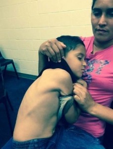 A little boy in detention in Texas suffers from an untreated rash. Detainees in detention centers in Texas have testified that they do not receive proper medical care.